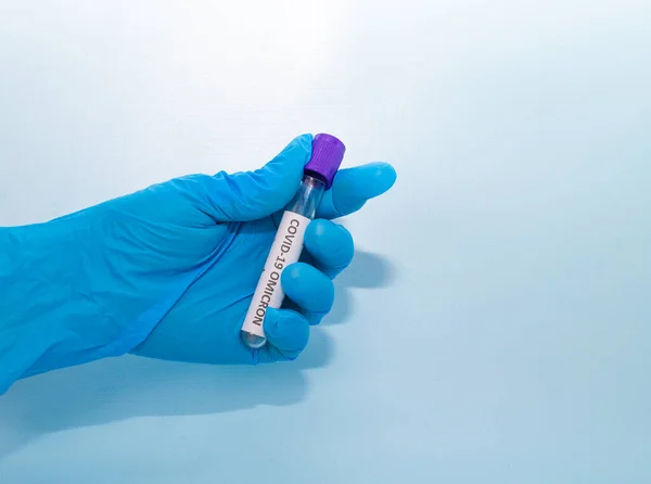 Rurka Próżniowa Pobierania Próbek Krwi Niebieskich Rękawiczkach Laboratorium Niebieskim Tle — Zdjęcie stockowe