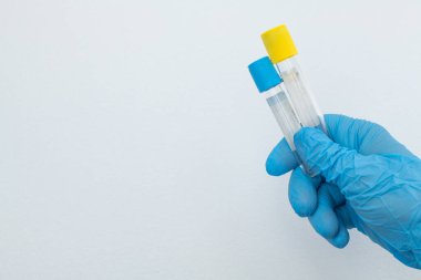 Two vacuum tubes for collection and blood samples with sodium citrate in blue gloves for laboratory. On white background