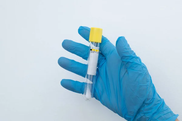 Vacuum Tube Collection Blood Samples Sodium Citrate Blue Gloves Laboratory — ストック写真