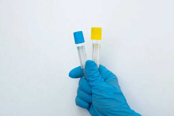 Two Vacuum Tubes Collection Blood Samples Sodium Citrate Blue Gloves — 图库照片