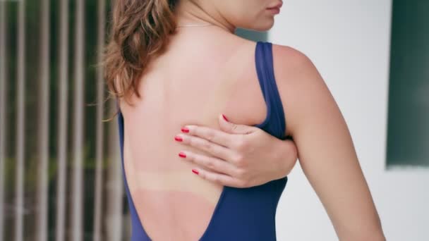 A woman in a blue swimsuit and with red manicure touches her back, reddened from the sun. A girl touches her back, on which there was a trace of a sunburn in the shape of a swimsuit, against wall. — Stock Video