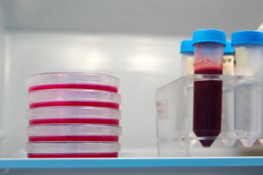 Makro, laboratuvar masasındaki beş şeffaf plastik kap dolusu kırmızı madde sıvısıyla dolu test tüpünü kapat.