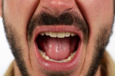 Ağzını kocaman açan, kalın sakallı, beyaz arka planda stüdyoda izole edilmiş bir adamın yakın plan fotoğrafı.