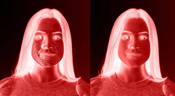 Computerized View Female Face Show Rosacea Treatment Infrared Vision Simulation — Zdjęcie stockowe