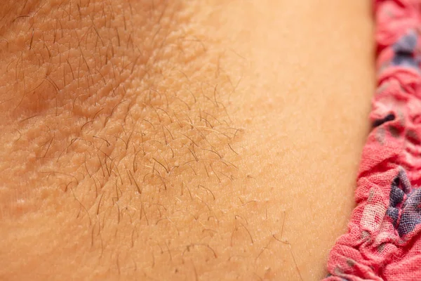 Close Detail Human Skin Tiny Hair Texture Human Skin Regrowing — Stock Fotó