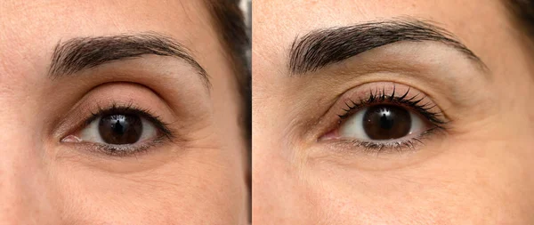 Eyelash Lamination Woman Eye Treatment Lash Lift Aesthetic Treatment Curl — Stock Photo, Image