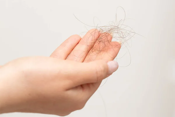 Макро Одной Руки Женщины Выпавшими Волосами Изолированные Белом Фоне Массивная — стоковое фото