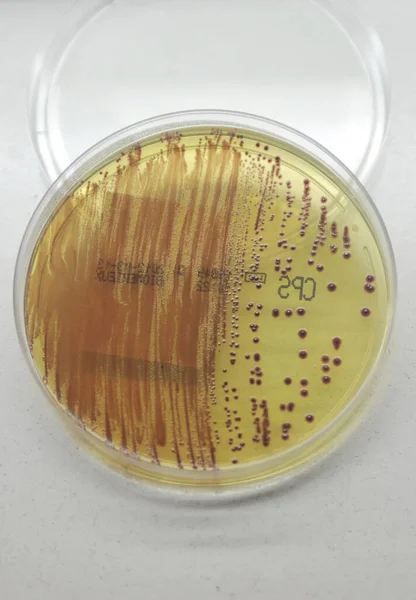 Лабораторное Оборудование Медицинского Анализа Картинке Коробка Образцами Покрытием Бактерий — стоковое фото
