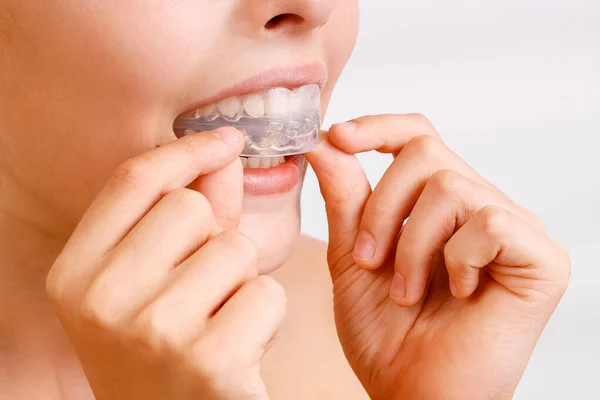 Oğlan ortodontik silikon antrenör ya da gece bekçisi çantası giyiyor. Görünmez diş telleri ortodontik probleme yardımcı olur. Yakın plan portre. Diş düzeltmesi için mobil aygıt.