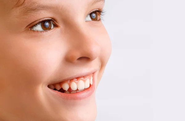Close Retrato Menino Feliz Sorrindo Fundo Branco Mostrando Dentes Saudáveis — Fotografia de Stock