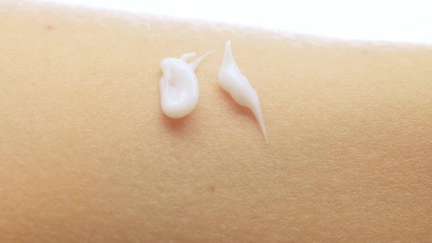 Крупним планом знімок крему для догляду за зволожувачем рук на сухій шкірі жінки — стокове відео