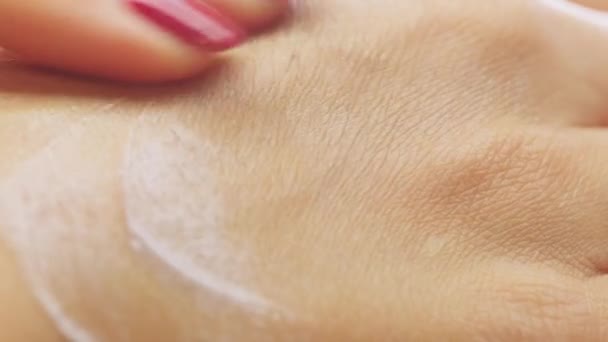 Applicando lozione idratante e crema cosmetica sulla pelle secca della mano delle donne — Video Stock