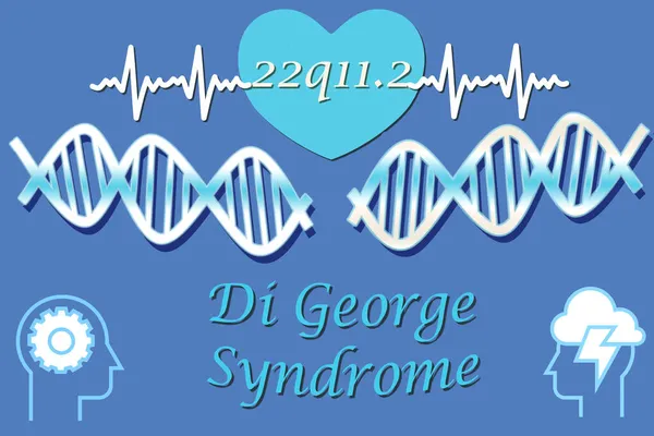 Ilustração Sobre Síndrome Microdeleção Cromossomo Síndrome George Apanha 22Q11 Imagem De Stock