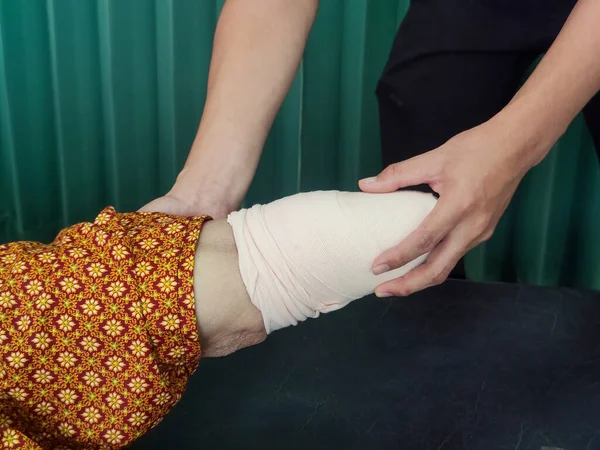 Below knee amputation bandaging for BK prosthesis.