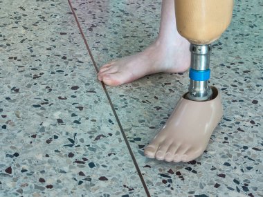 BK disability using and training leg prothesis