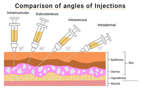 316 Intramuscular injection Vector Images | Depositphotos
