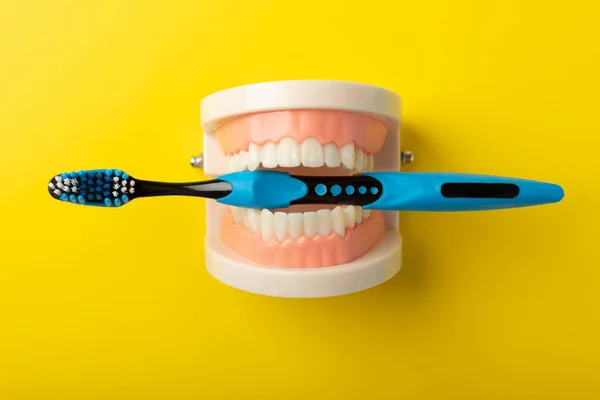 Prótesis Con Cepillo Dientes Azul Sobre Fondo Amarillo Mandíbulas Superiores — Foto de Stock