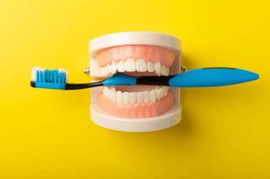 Sarı arka planda mavi diş fırçası olan takma dişler. Üst ve alt çeneler takma dişlerle. Takma dişler ya da takma dişler, yakın plan. Kopyala uzayı. Cariesleri önleme.