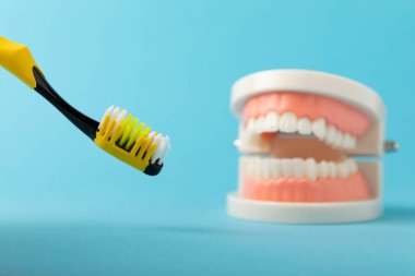 Dentures with a toothbrush on a blue background.Upper and lower jaws with false teeth. Dentures or false teeth, close-up. copy space.MOCKUP