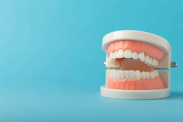 Dentiere Sfondo Azzurro Mascelle Superiori Inferiori Con Denti Falsi Dentiere — Foto Stock