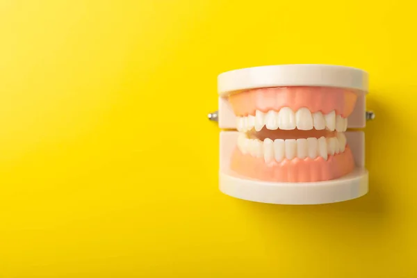 Dentures on a yellow background.Upper and lower jaws with false teeth. Dentures or false teeth, close-up. copy space.MOCKUP