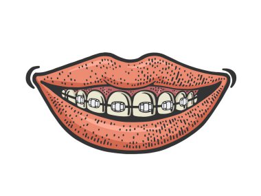 Diş telleri gülümseme rengi çizim vektörü