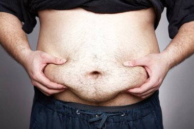 Bir Adam Gri Arkaplanda Aşırı Göbek Şişmanlığı ve Gerilme İzlerini Sıkar.