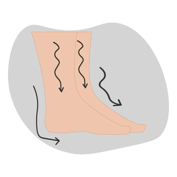 Gonflement Des Pieds Des Jambes — Image vectorielle