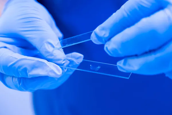 Feche as mãos de doutores em luvas carregam a amostra biológica em um copo do microscópio. Exame sanguíneo — Fotografia de Stock