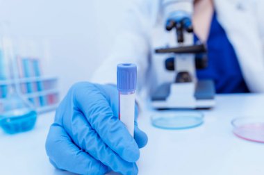 Kopya alanı olan kan örneği şişesi. Doktorların elinde kan örneği şişesi var. PCR Covid-19 kan testi konsepti