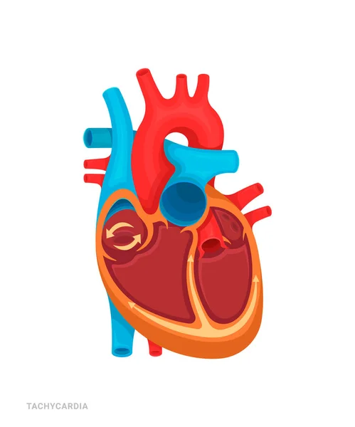心脏缺陷 心动过速医药书籍 应用程序的说明 有名字的心脏病 — 图库矢量图片