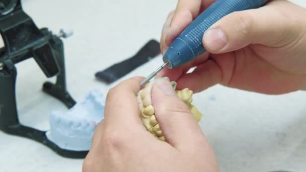 研究室で人工入れ歯を作る専門家のビデオを閉じる — ストック動画
