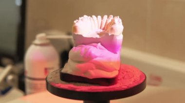 Yapay diş için 3D diş taraması videosu.