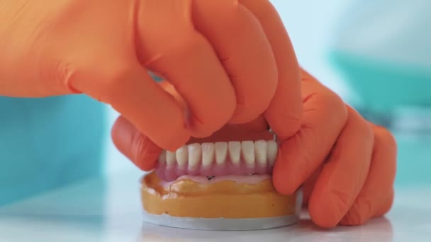 假牙牙根、假牙工作的牙医的近视视频 — 图库视频影像