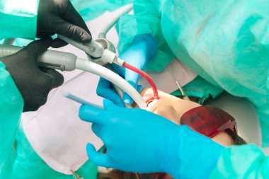 Ağzı açık genç bir kadın üzerinde yapılan dişler için yapılan bir prosedür fotoğrafı. İki dişçi çalışıyor..