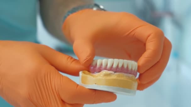 Primer vídeo del médico sosteniendo dentaduras postizas en las manos y mostrando el modelo para el cliente — Vídeo de stock