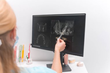 Kadın dişçi, radyoloji filmi ile ekranı bir dişle işaret ediyor..