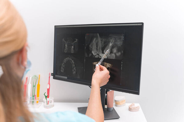 Female dentist is pointing with a toolat the screen with radiology film of some teeth.