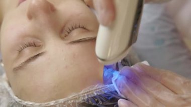 Close up footage of doctor making skin care procedure with ultrasonic laser.
