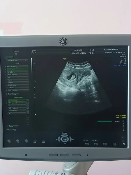 screen of a monitor with a picture of a doctor