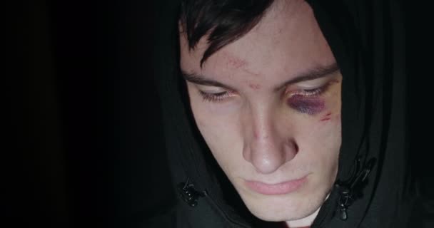 Egy fiatal férfi zúzódásokkal a szeme alatt belenéz a kamerába. A családon belüli erőszak fogalmának áldozatai — Stock videók
