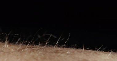 On the skin of a man hairs rise due to strong arousal or stress
