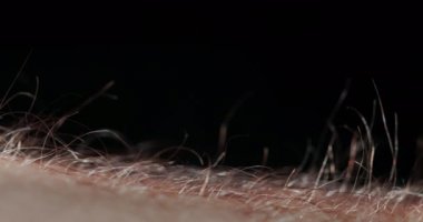 On a mans hand, the hairs rise up - severe stress or fear. Horror hair stands on end, animal fear