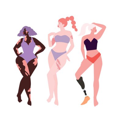 Feminist kadın grubu. Beyaz arka planda güzel çeşitlilikteki kadınlar. Pozitif vücut pozları. Vücudunu sev. Vitiligo, aşırı kilolu, protez bacaklı, gerilme izleri, kllülit....