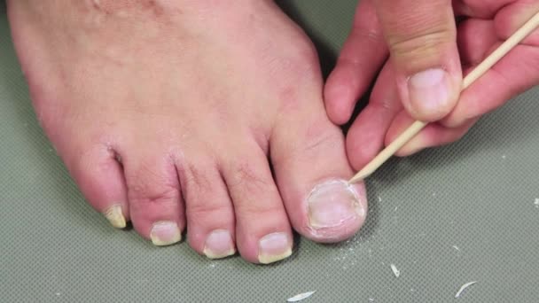 Uma mão de homem com um bastão de laranja remove a cutícula do dedo grande do pé. — Vídeo de Stock