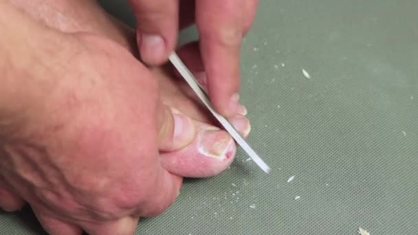 Una mano di uomo infila l'unghia dell'alluce con una lima. — Video Stock