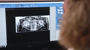 Doktor ekrandaki diş röntgenlerine bakıyor.
