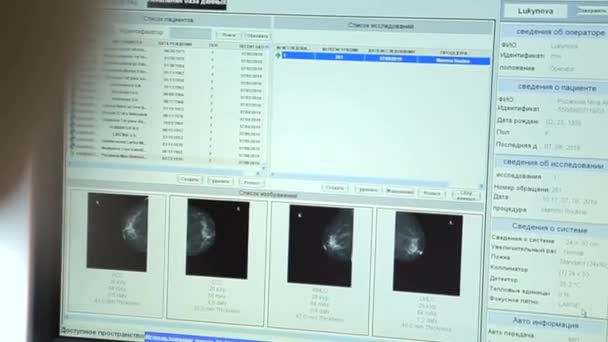 Dokter melihat sinar-x dari payudara di layar — Stok Video