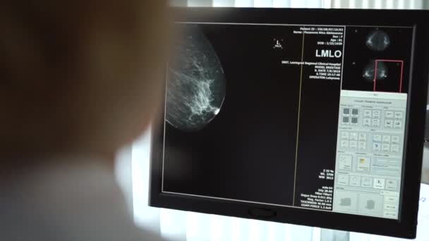 Doctor looking at x-rays of the breast on the screen — Stock Video