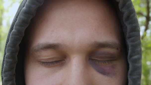 Hombre triste en la capucha con moretones y abrasiones debajo del ojo — Vídeos de Stock
